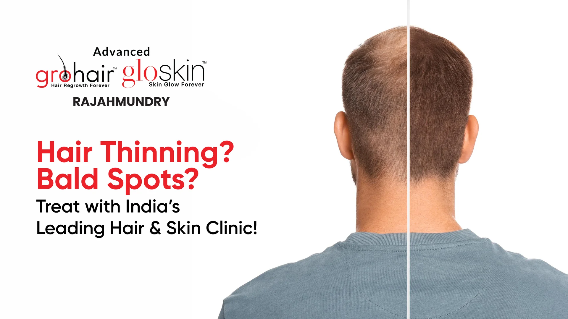 Glow Skin Service in Kothapet